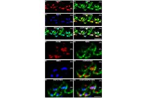 Confocal images of semi-thin sections of the mouse retina triple-immunolabelled with mouse monoclonal antibodies against CASPR1, rabbit polyclonal antibodies against PSD-95 (L667) and rabbit polyclonal antibodies against RIBEYE (U2656), as described in the Materials and Methods section. (Rabbit anti-Mouse IgG (Heavy & Light Chain) Antibody)