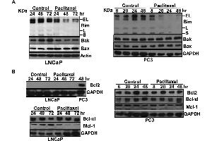 Western Blotting (WB) image for anti-Glyceraldehyde-3-Phosphate Dehydrogenase (GAPDH) antibody (ABIN2857072)