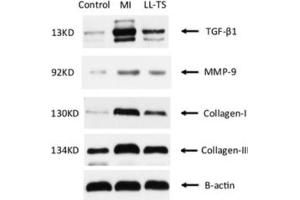 Western Blotting (WB) image for RIPA Lysis Buffer (ABIN5706373)